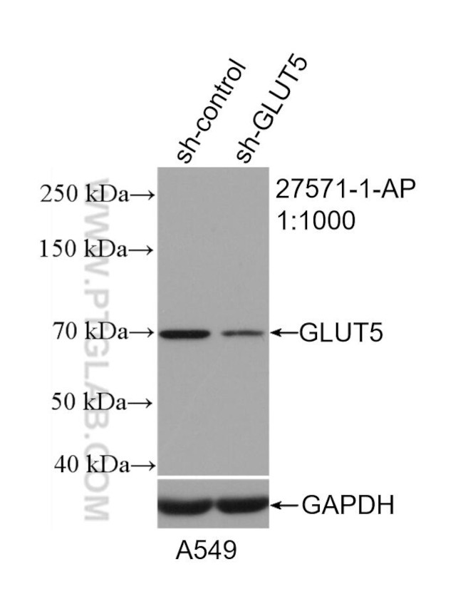GLUT5 Antibody in Western Blot (WB)