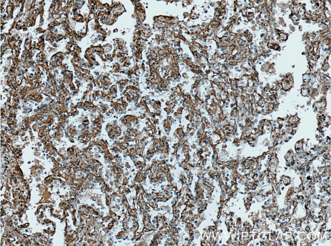 HAI-1 Antibody in Immunohistochemistry (Paraffin) (IHC (P))