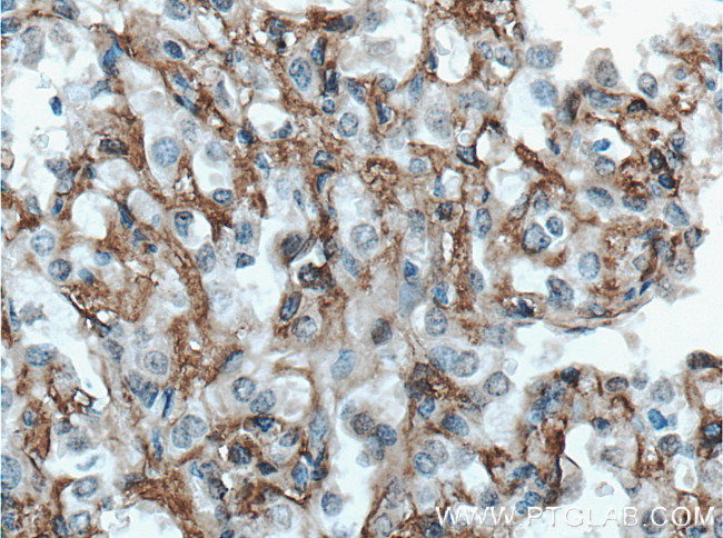 HAI-1 Antibody in Immunohistochemistry (Paraffin) (IHC (P))