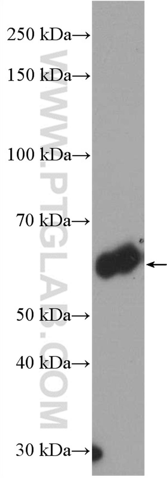 HAI-1 Antibody in Western Blot (WB)