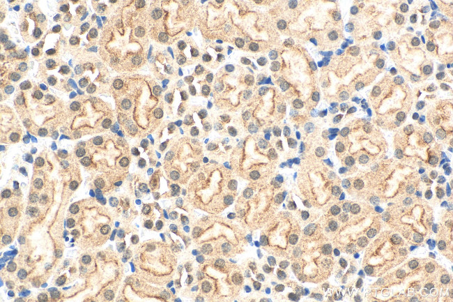 HSPBAP1 Antibody in Immunohistochemistry (Paraffin) (IHC (P))