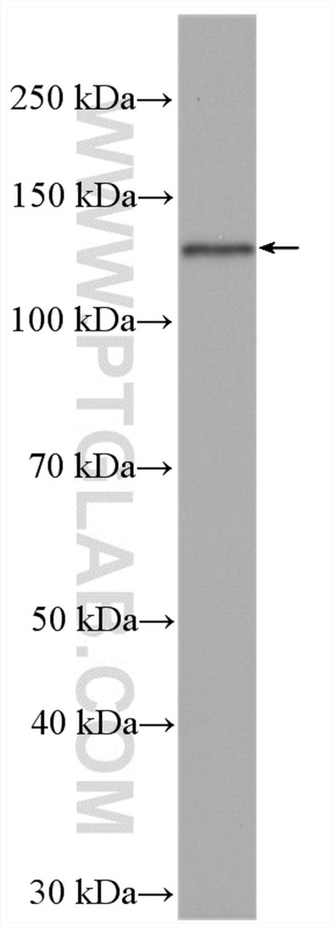 BACH2 Antibody in Western Blot (WB)