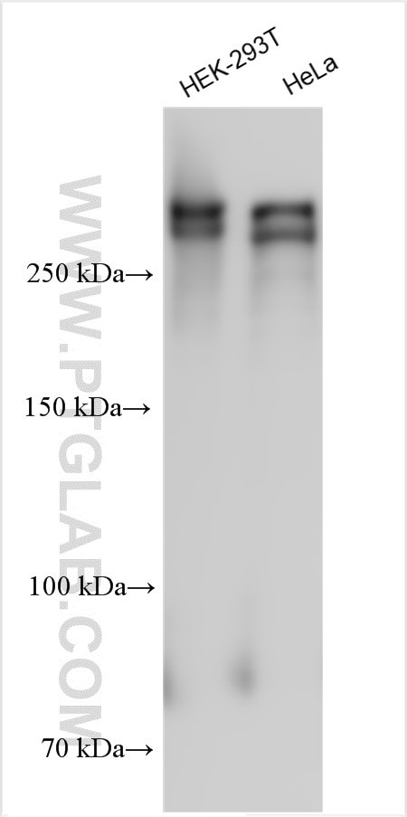 ANKRD17 Antibody in Western Blot (WB)