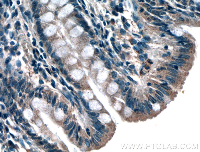 GET4 Antibody in Immunohistochemistry (Paraffin) (IHC (P))