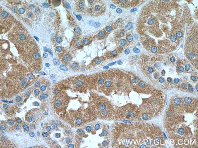 HSD17B1 Antibody in Immunohistochemistry (Paraffin) (IHC (P))