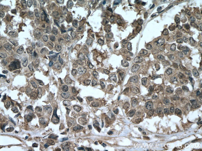 AKAP13 Antibody in Immunohistochemistry (Paraffin) (IHC (P))