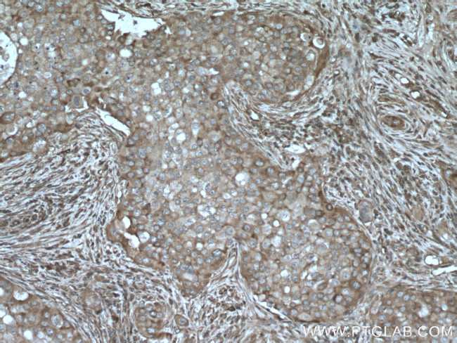 AKAP13 Antibody in Immunohistochemistry (Paraffin) (IHC (P))