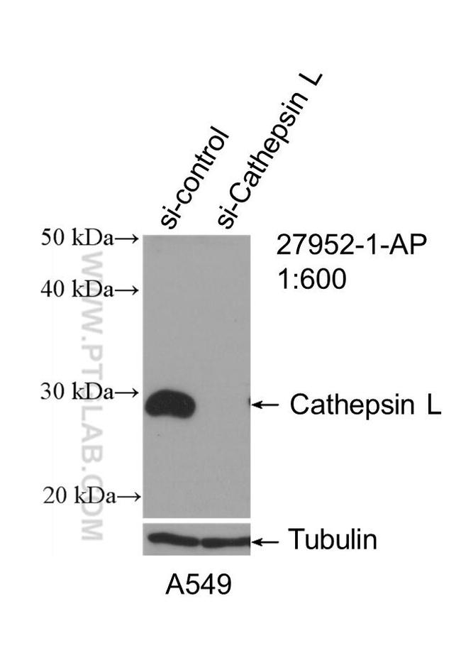 Cathepsin L Antibody in Western Blot (WB)