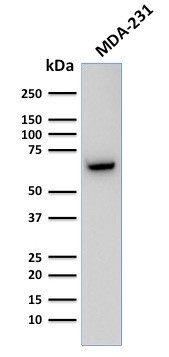 GnRH-Receptor/LH-RH Receptor Antibody in Western Blot (WB)