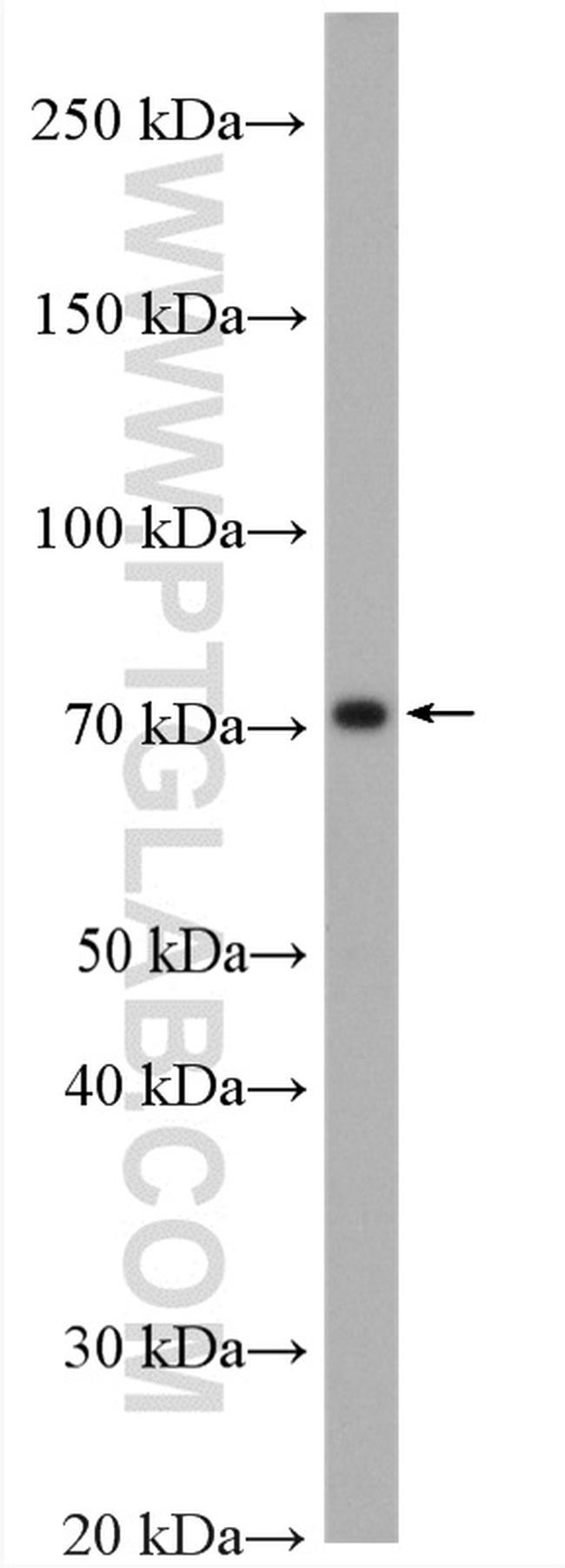 ABLIM3 Antibody in Western Blot (WB)