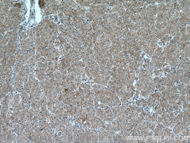 SLC22A9 Antibody in Immunohistochemistry (Paraffin) (IHC (P))