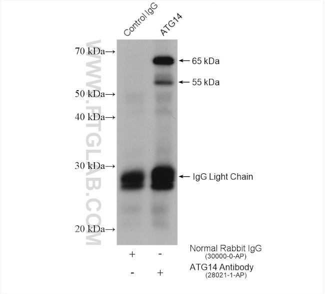 ATG14 Antibody in Immunoprecipitation (IP)