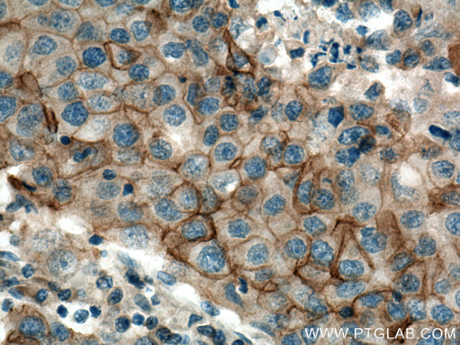 SLC12A2 Antibody in Immunohistochemistry (Paraffin) (IHC (P))