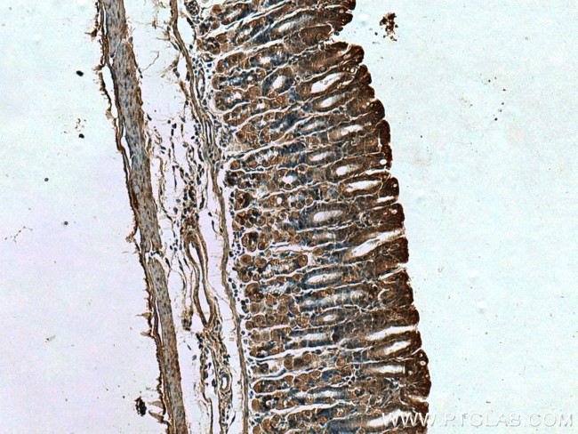 RSAD2 Antibody in Immunohistochemistry (Paraffin) (IHC (P))