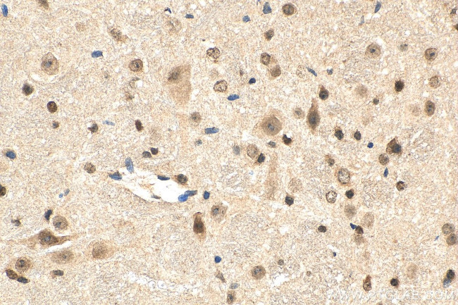 L3MBTL3 Antibody in Immunohistochemistry (Paraffin) (IHC (P))