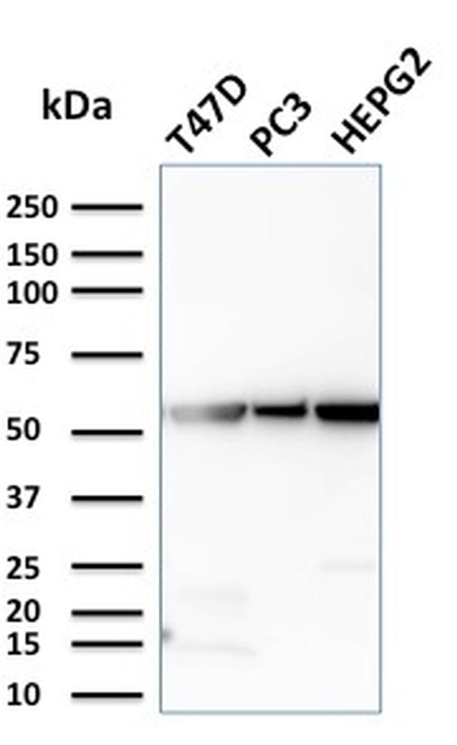 Glucose 6-Phosphate Isomerase Monoclonal Antibody (CPTC-GPI-1)  (2821-MSM1-P1ABX)