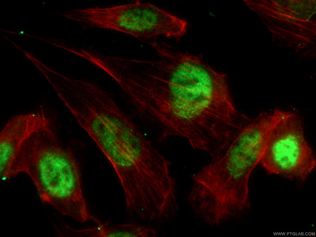 p21 Antibody in Immunocytochemistry (ICC/IF)