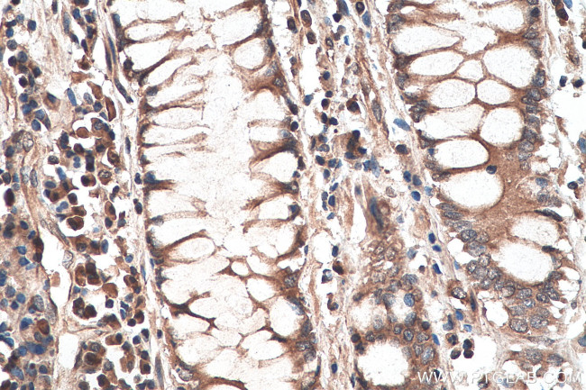 GLI3 Antibody in Immunohistochemistry (Paraffin) (IHC (P))