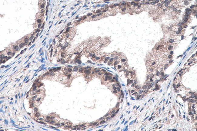 GLI3 Antibody in Immunohistochemistry (Paraffin) (IHC (P))