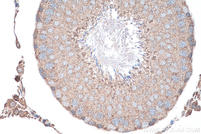 GLI3 Antibody in Immunohistochemistry (Paraffin) (IHC (P))