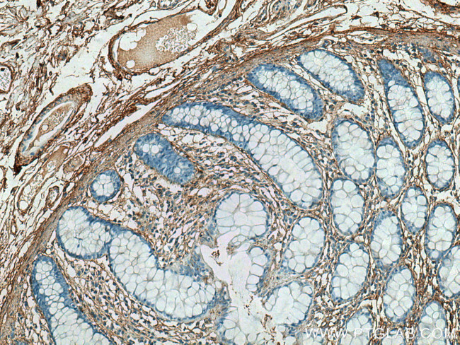 Collagen Type V Antibody in Immunohistochemistry (Paraffin) (IHC (P))