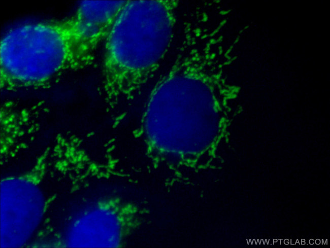 PGAM5 Antibody in Immunocytochemistry (ICC/IF)