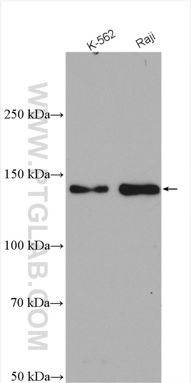 CARD11 Antibody in Western Blot (WB)