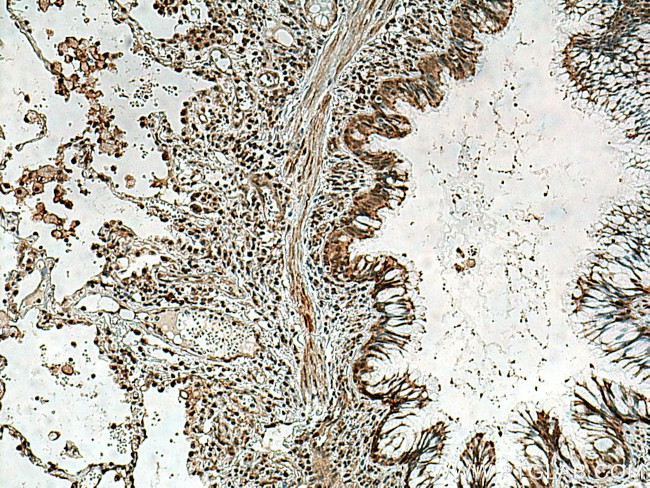 CENPF Antibody in Immunohistochemistry (Paraffin) (IHC (P))