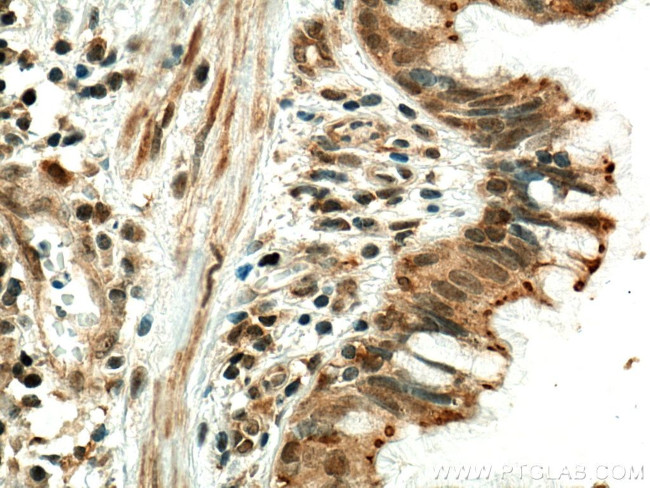 CENPF Antibody in Immunohistochemistry (Paraffin) (IHC (P))