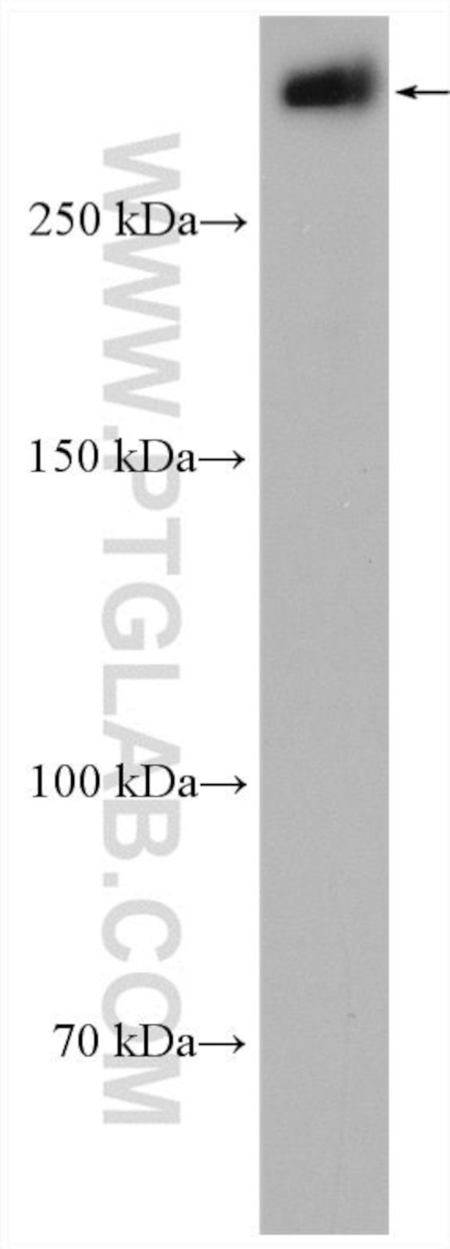 CENPF Antibody in Western Blot (WB)