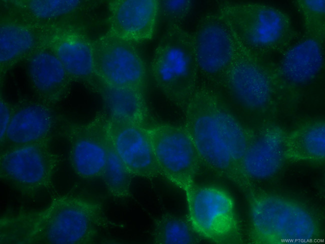 Claudin 1 Antibody in Immunocytochemistry (ICC/IF)