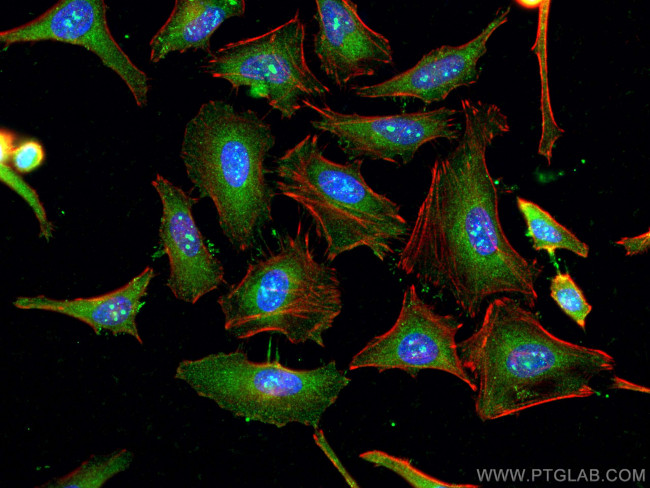 WIPI2 Antibody in Immunocytochemistry (ICC/IF)