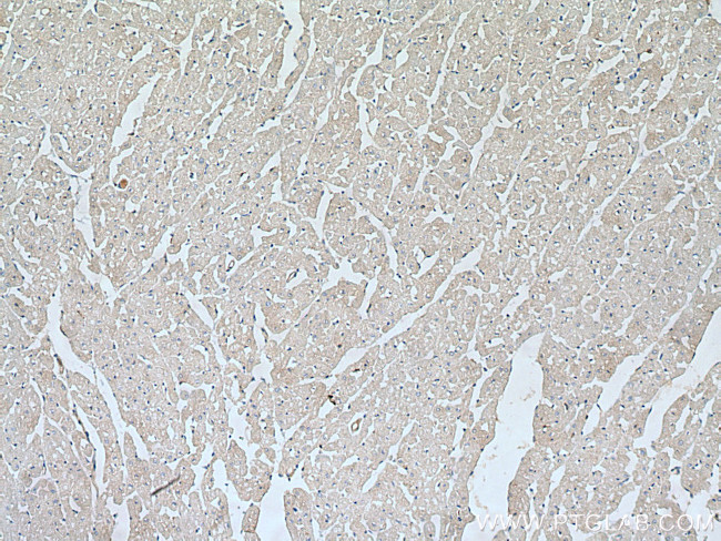 WIPI2 Antibody in Immunohistochemistry (Paraffin) (IHC (P))