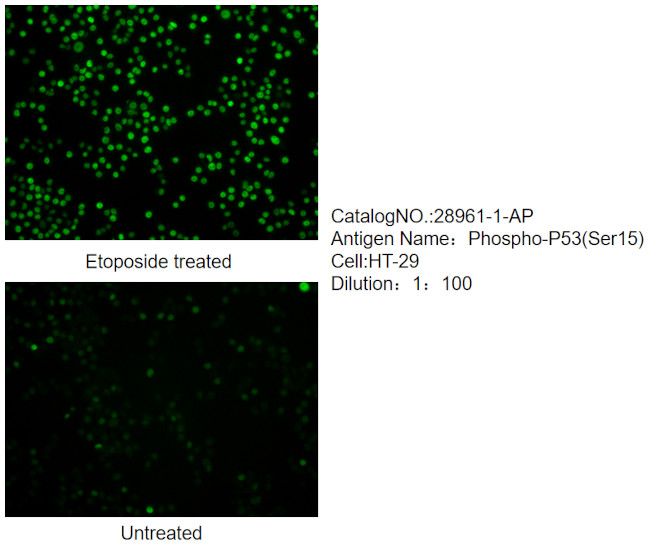 Phospho-P53 (Ser15) Antibody in Immunocytochemistry (ICC/IF)