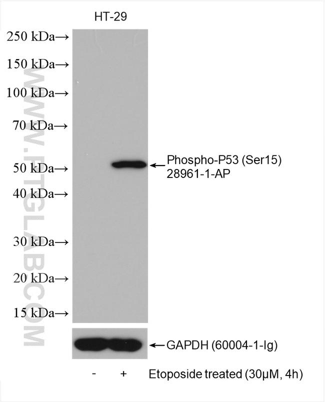 Phospho-P53 (Ser15) Antibody in Western Blot (WB)