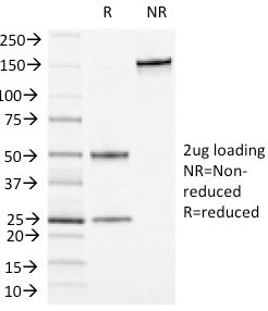 CD13/Aminopeptidase-N (Myeloid Cell Marker) Antibody in SDS-PAGE (SDS-PAGE)