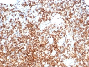 CD13/Aminopeptidase-N (Myeloid Cell Marker) Antibody in Immunohistochemistry (Paraffin) (IHC (P))