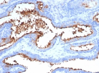 CD13/Aminopeptidase-N (Myeloid Cell Marker) Antibody in Immunohistochemistry (Paraffin) (IHC (P))