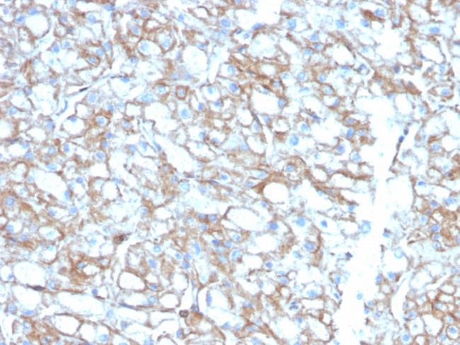 PD-L1/PDCD1LG1/CD274/B7-H1 (Cancer Immunotherapy Target) Antibody in Immunohistochemistry (Paraffin) (IHC (P))