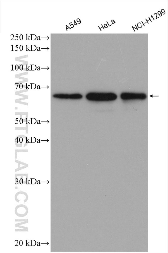 CBLL1 Antibody in Western Blot (WB)