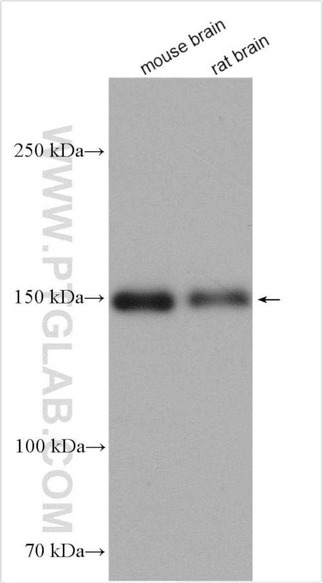 nNOS Antibody in Western Blot (WB)