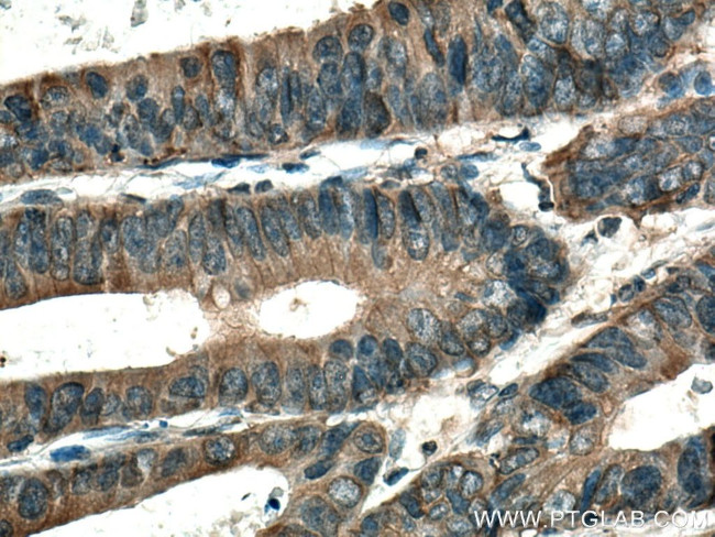 SAP 97 Antibody in Immunohistochemistry (Paraffin) (IHC (P))