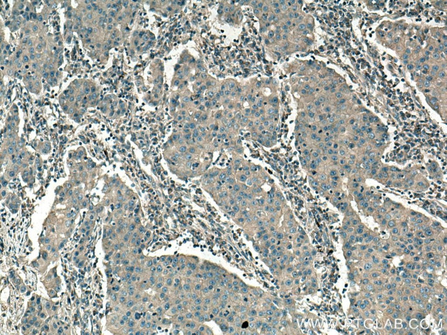 SAP 97 Antibody in Immunohistochemistry (Paraffin) (IHC (P))