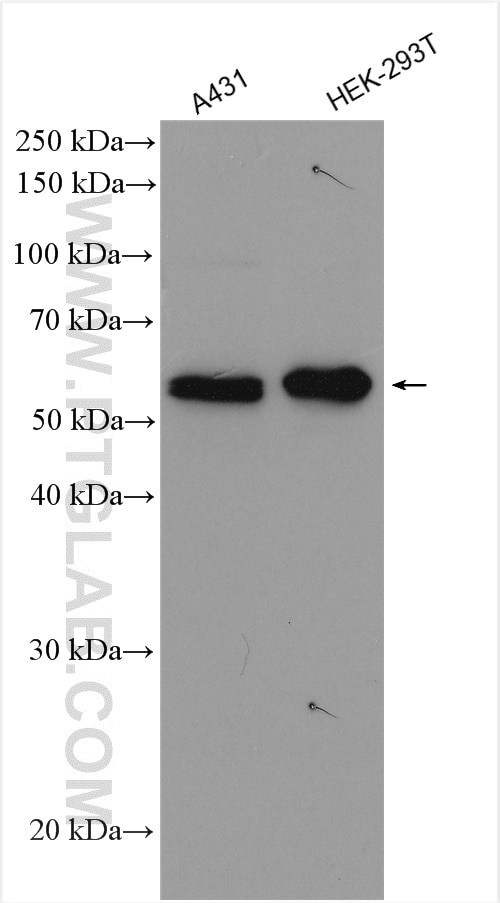 STK11/LKB1 Antibody in Western Blot (WB)