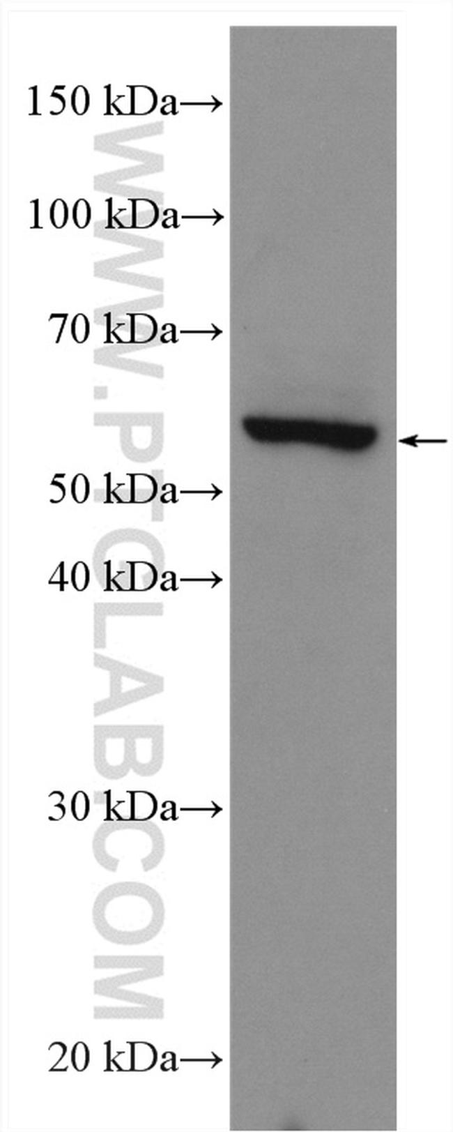 Cannabinoid receptor 2 Antibody in Western Blot (WB)