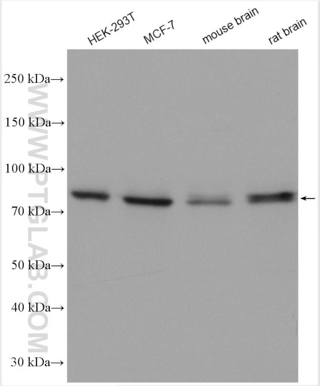 TPBG Antibody in Western Blot (WB)