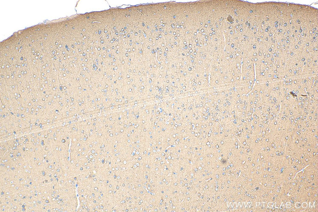 CRMP1 Antibody in Immunohistochemistry (Paraffin) (IHC (P))