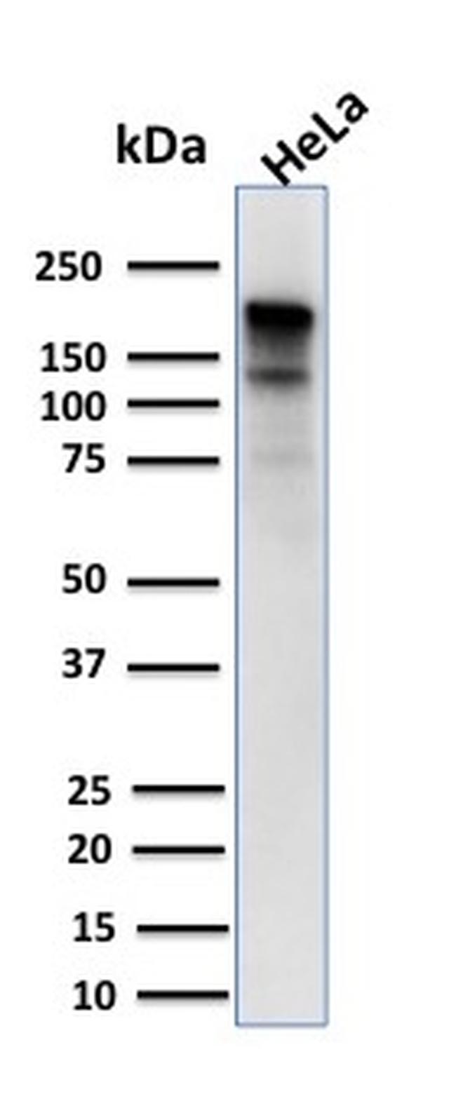 MSH6 (DNA Mismatch Repair Protein) Antibody in Western Blot (WB)