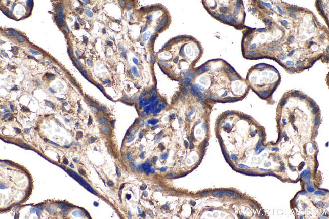 EBP50/NHERF-1 Antibody in Immunohistochemistry (Paraffin) (IHC (P))