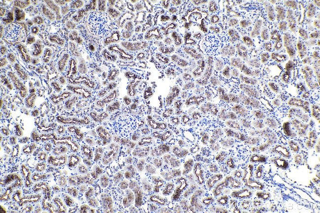 EBP50/NHERF-1 Antibody in Immunohistochemistry (Paraffin) (IHC (P))